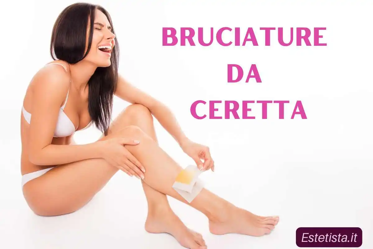 rimedi bruciature da ceretta