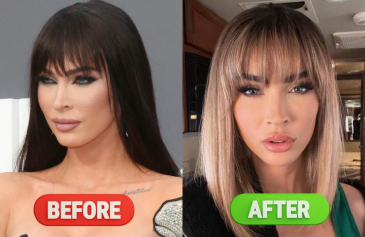 megan fox prima e dopo