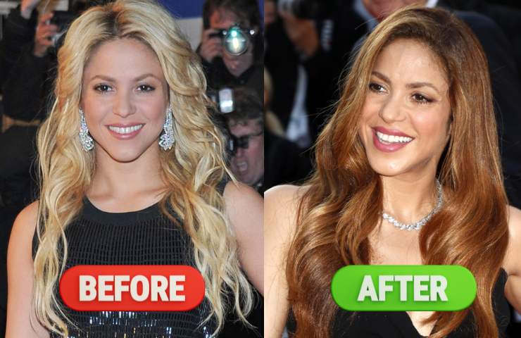 shakira prima e dopo