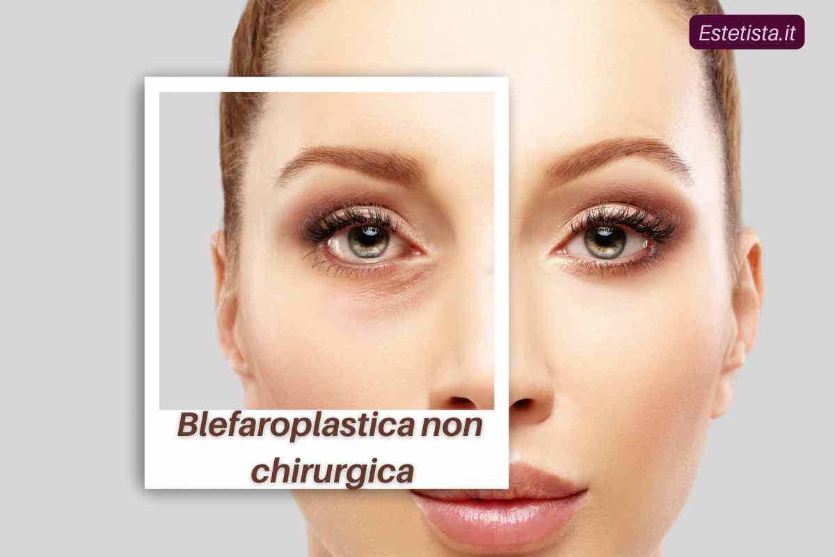 Blefaroplastica non chirurcica vantaggi rispetto alla chirurgica