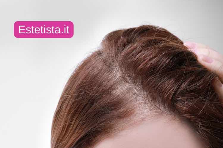 Rimedi ai capelli che cadono