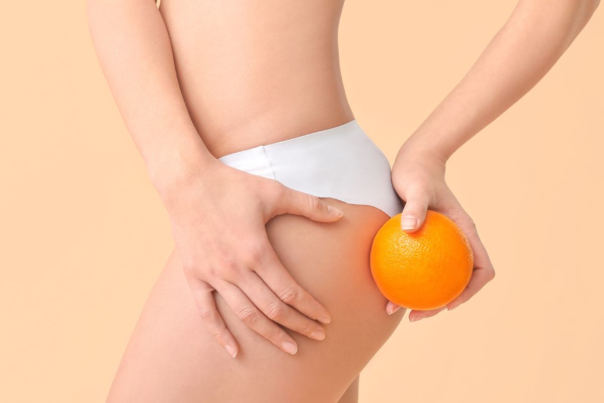 cellulite miti da sfatare