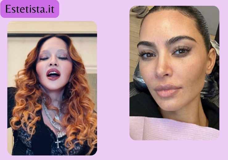 madonna e kim kardashian clienti del dermaplaning