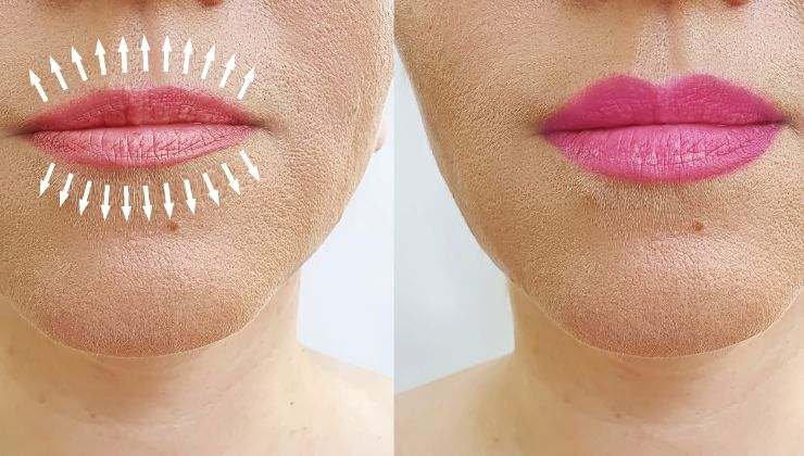 Migliora l'aspetto delle tue labbra sottili