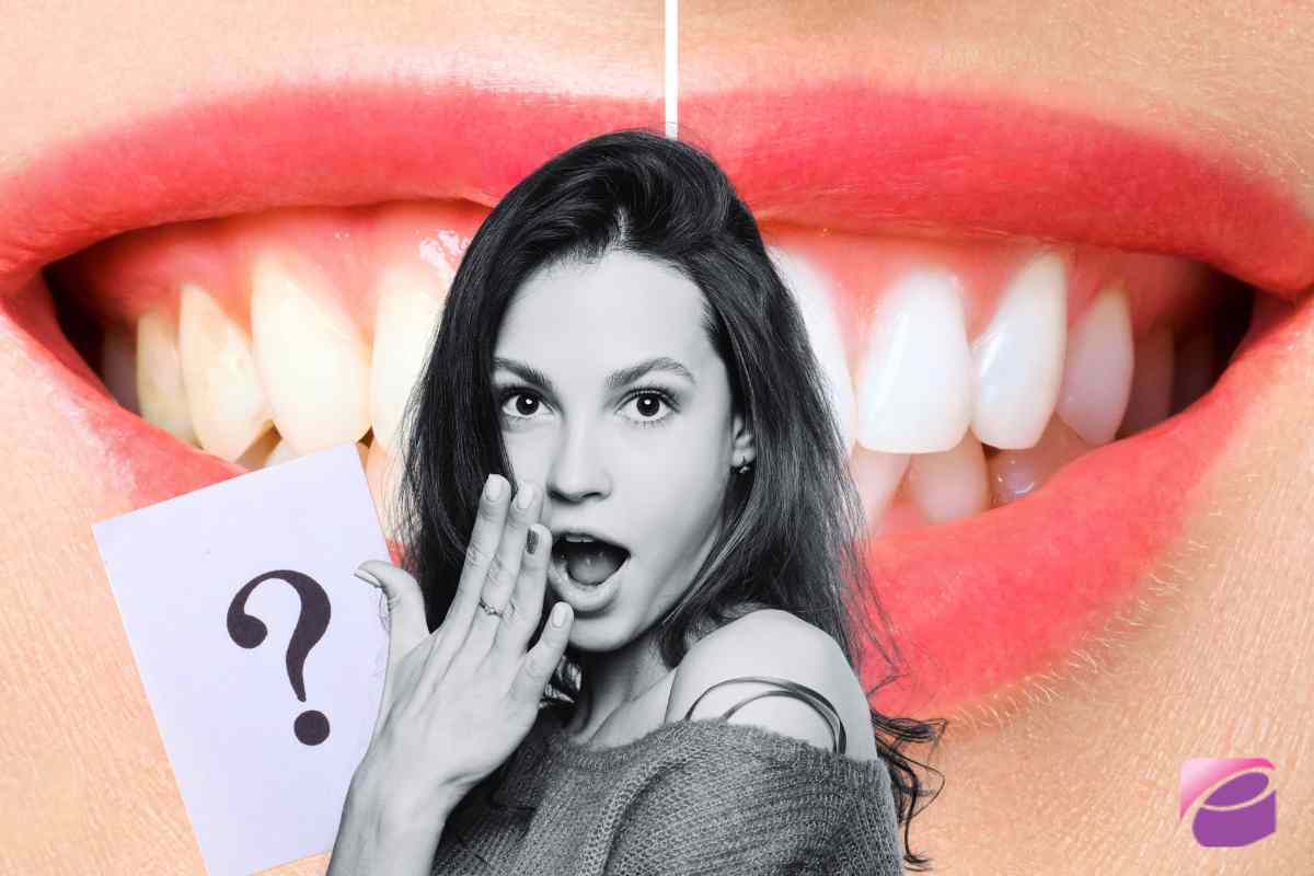 metodo per avere i denti più bianchi