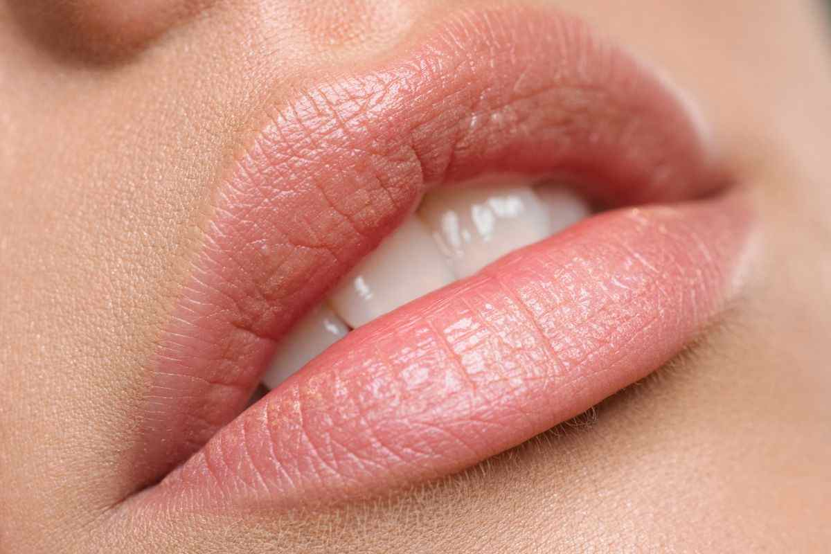Filler labbra prodotti alternativi