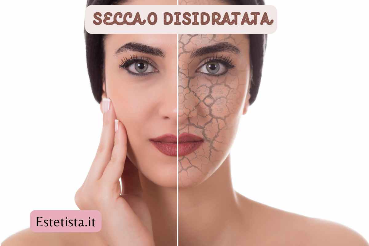 viso con pelle secca o disidratata