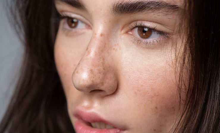 Come valorizzare le lentiggini con il makeup