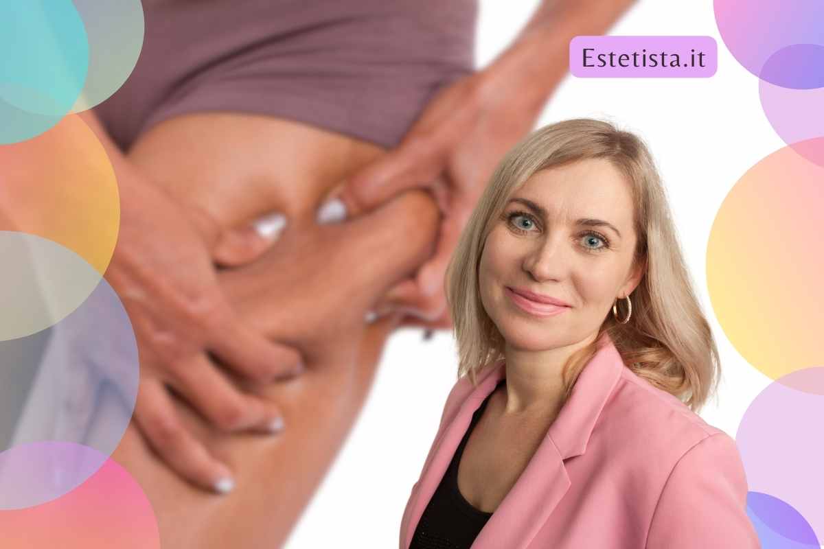 cellulite dopo i 50 anni