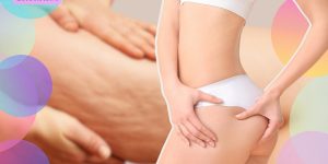 rimedi per cellulite e ritenzione