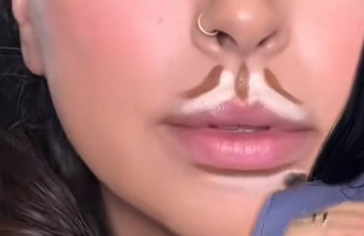 come fare lip contouring